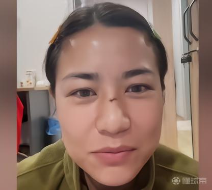 中国女足李佳悦 加拉塔萨雷 鼻梁骨骨折_李佳悦