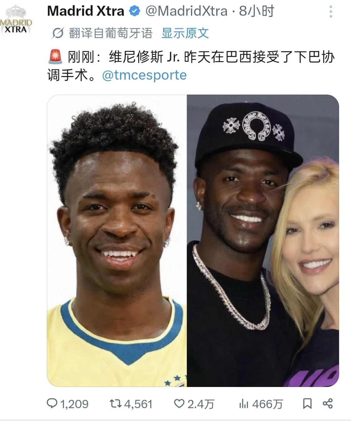 打下巴了？世界杯休假后维尼修斯医美整形在社媒走红